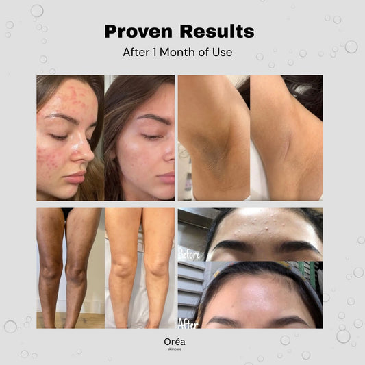 Oréa - Glycolic Acid Toner