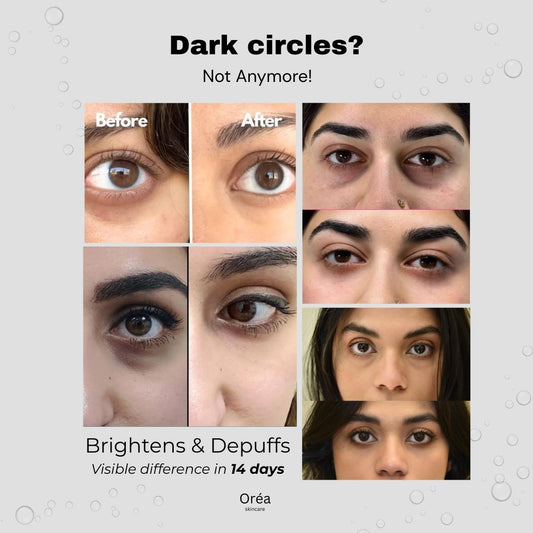 Oréa - Dark Circle Corrector